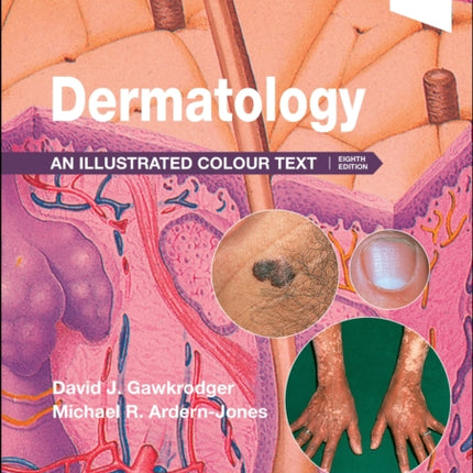 Dermatology