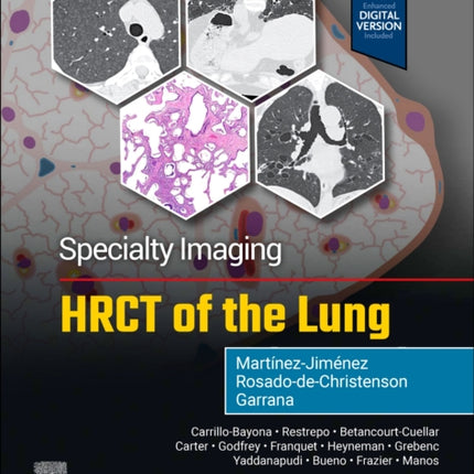 Specialty Imaging HRCT of the Lung