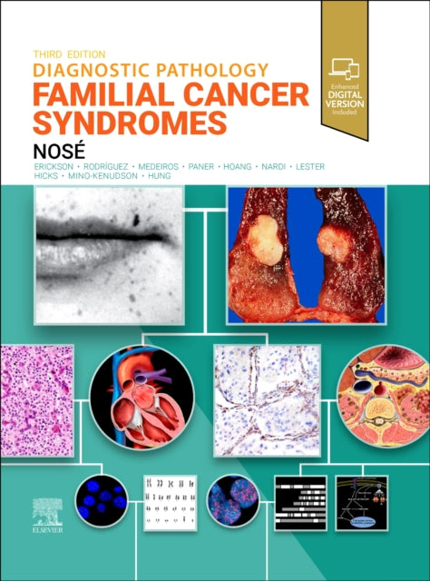 Diagnostic Pathology Familial Cancer Syndromes