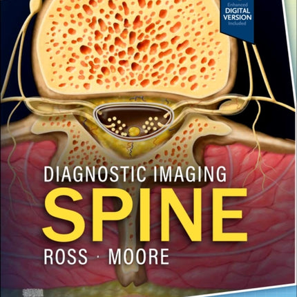 Diagnostic Imaging Spine