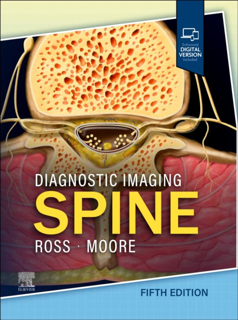 Diagnostic Imaging Spine