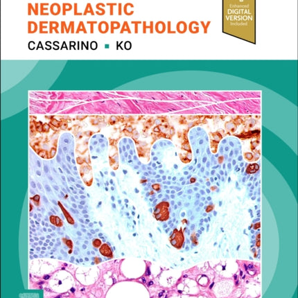 Diagnostic Pathology Neoplastic Dermatopathology