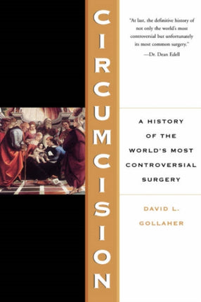 Circumcision A History Of The Worlds Most Controversial Surgery