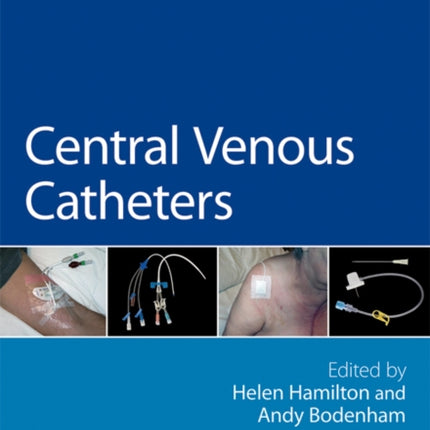 Central Venous Catheters