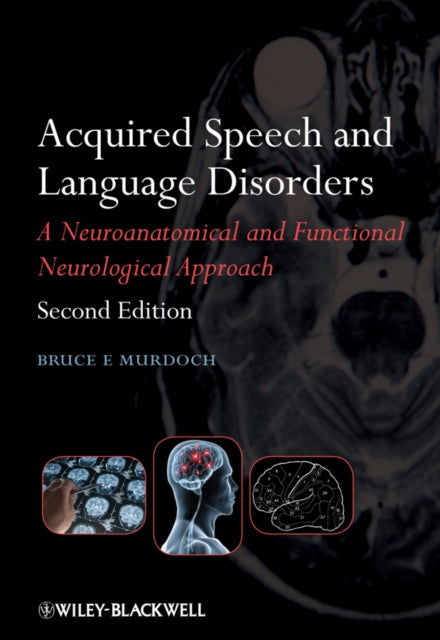 Acquired Speech and Language Disorders