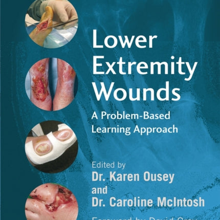 Lower Extremity Wounds: A Problem-Based Approach