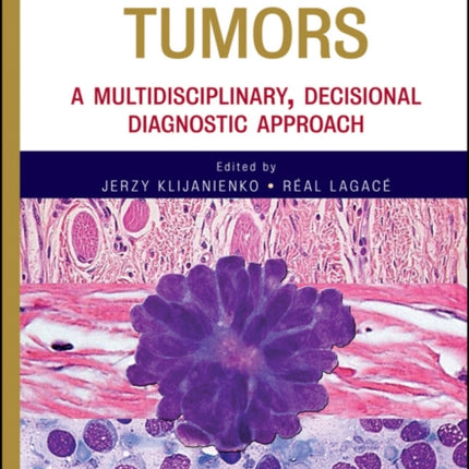 Soft Tissue Tumors