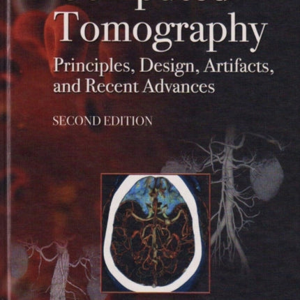 Computed Tomography Principles Design Artifacts