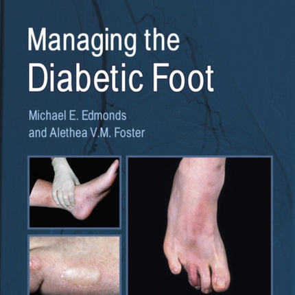 Managing the Diabetic Foot