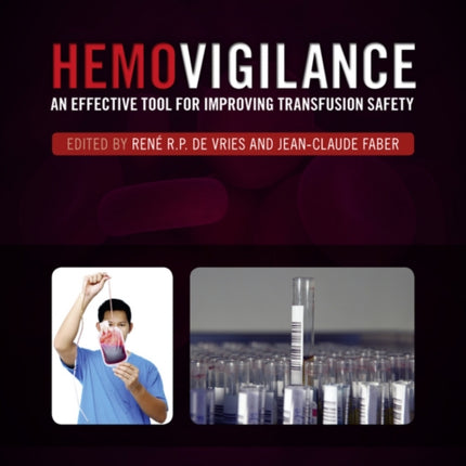 Hemovigilance: An Effective Tool for Improving Transfusion Safety