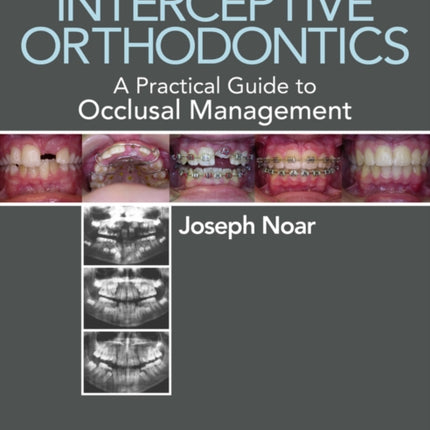 Interceptive Orthodontics A Practical Guide to