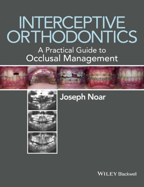 Interceptive Orthodontics A Practical Guide to