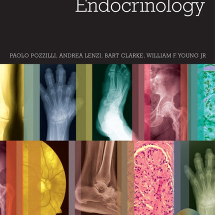 Imaging in Endocrinology