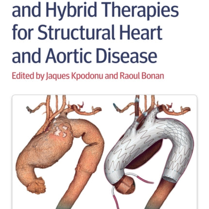 Endovascular and Hybrid Therapies for Structural Heart and Aortic Disease