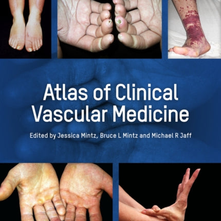 Atlas of Clinical Vascular Medicine