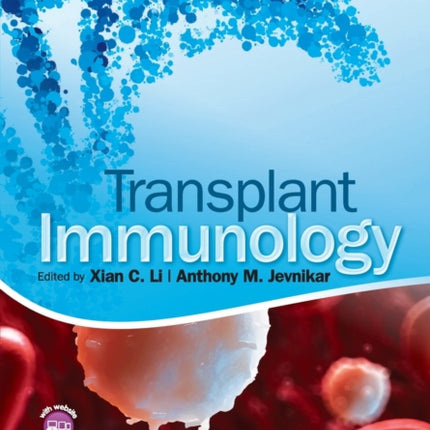 Transplant Immunology