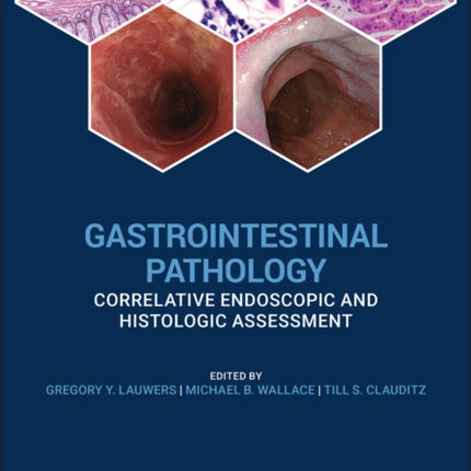 Gastrointestinal Pathology: Correlative Endoscopic and Histologic Assessment