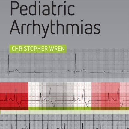 Concise Guide to Pediatric Arrhythmias