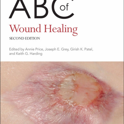 ABC of Wound Healing
