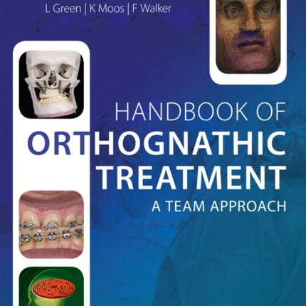 Handbook of Orthognathic Treatment