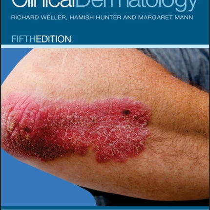 Clinical Dermatology