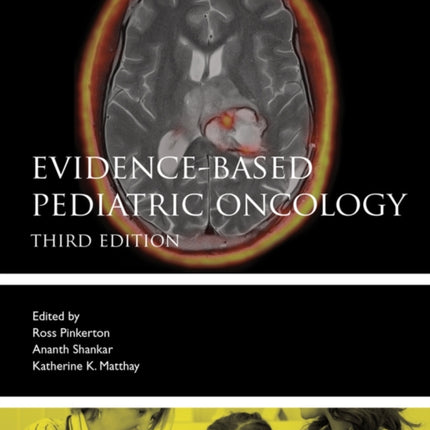 Evidence-Based Pediatric Oncology