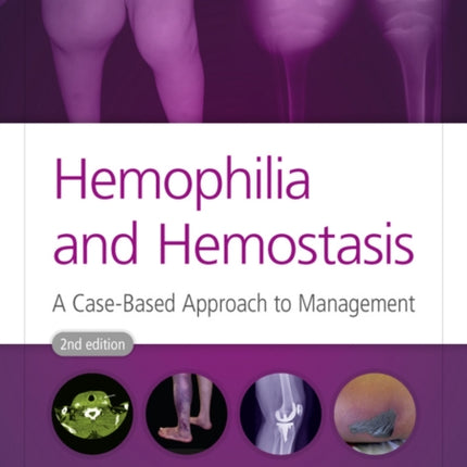 Hemophilia and Hemostasis: A Case-Based Approach to Management