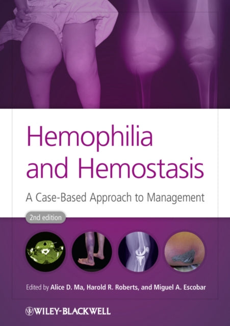 Hemophilia and Hemostasis: A Case-Based Approach to Management