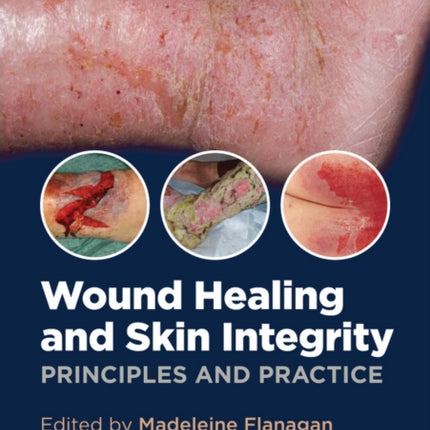 Wound Healing and Skin Integrity: Principles and Practice