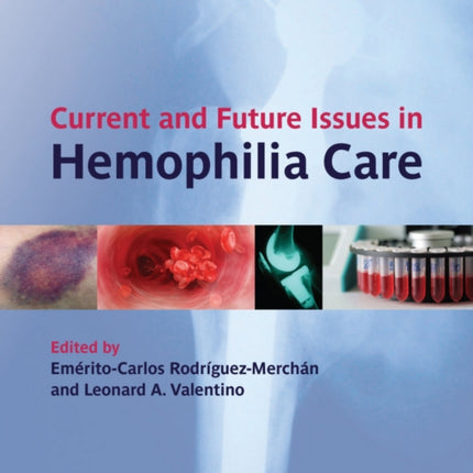 Current and Future Issues in Hemophilia Care