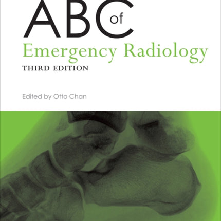 ABC of Emergency Radiology