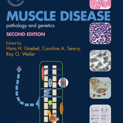 Muscle Disease: Pathology and Genetics