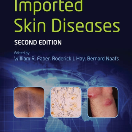 Imported Skin Diseases