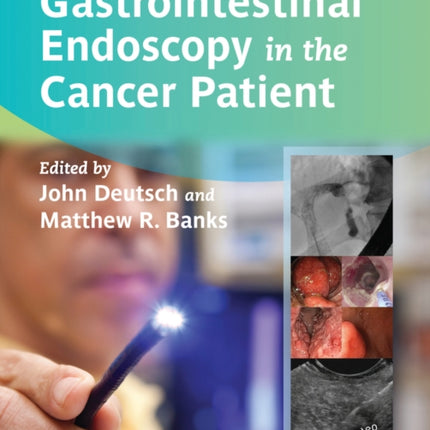 Gastrointestinal Endoscopy in the Cancer Patient