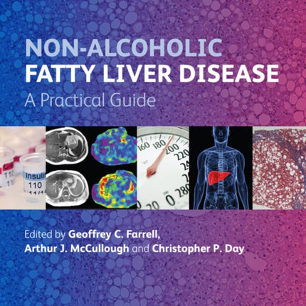 Non-Alcoholic Fatty Liver Disease: A Practical Guide