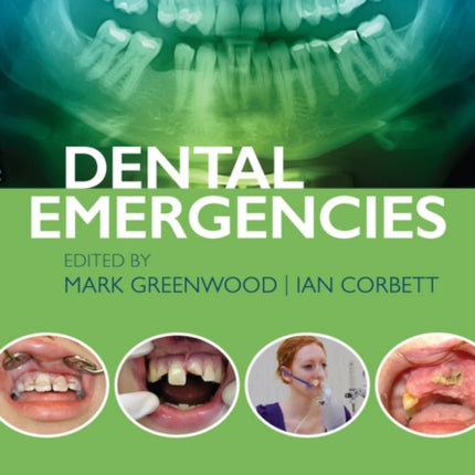 Dental Emergencies