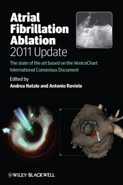 Atrial Fibrillation Ablation, 2011 Update: The State of the Art based on the VeniceChart International Consensus Document