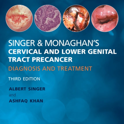 Singer and Monaghan's Cervical and Lower Genital Tract Precancer: Diagnosis and Treatment