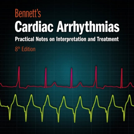 Bennett's Cardiac Arrhythmias: Practical Notes on Interpretation and Treatment