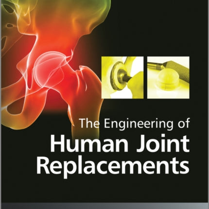 The Engineering of Human Joint Replacements