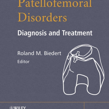 Patellofemoral Disorders
