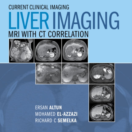 Liver Imaging: MRI with CT Correlation