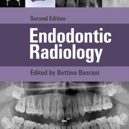 Endodontic Radiology
