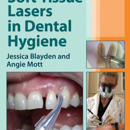SoftTissue Lasers in Dental Hygiene