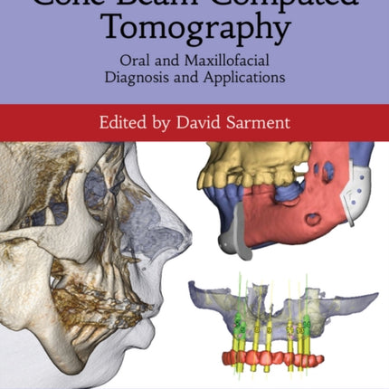 Cone Beam Computed Tomography: Oral and Maxillofacial Diagnosis and Applications