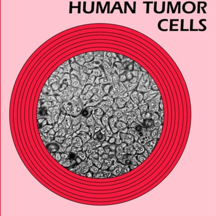 Culture of Human Tumor Cells