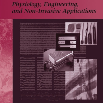 Electromyography: Physiology, Engineering, and Non-Invasive Applications