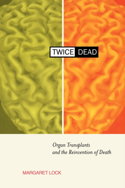 Twice Dead: Organ Transplants and the Reinvention of Death