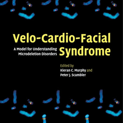 VeloCardioFacial Syndrome