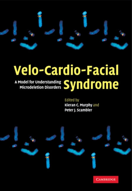 VeloCardioFacial Syndrome
